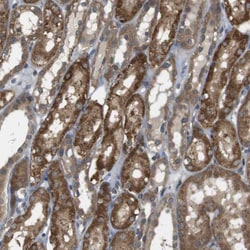 Invitrogen RNF130 Polyclonal Antibody 100 &mu;L; Unconjugated:Antibodies,