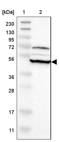 Invitrogen RNF130 Polyclonal Antibody 100 &mu;L; Unconjugated:Antibodies,