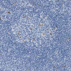 Invitrogen CD320 Polyclonal Antibody 100 &mu;L; Unconjugated:Antibodies,