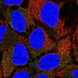 Invitrogen CLCN2 Polyclonal Antibody 100 μL; Unconjugated:Antibodies,