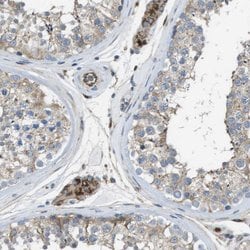Invitrogen CLCN2 Polyclonal Antibody 100 μL; Unconjugated:Antibodies,