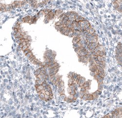 Invitrogen TMEM30A Polyclonal Antibody 100 &mu;L; Unconjugated:Antibodies,
