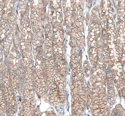 Invitrogen TMEM30A Polyclonal Antibody 100 &mu;L; Unconjugated:Antibodies,