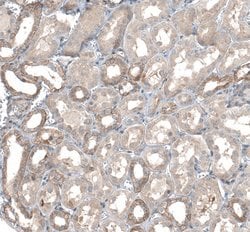 Invitrogen TMEM30A Polyclonal Antibody 100 &mu;L; Unconjugated:Antibodies,