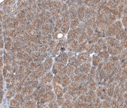Invitrogen TMEM30A Polyclonal Antibody 100 &mu;L; Unconjugated:Antibodies,