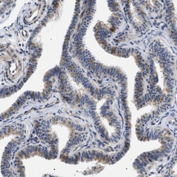 Invitrogen KIAA0355 Polyclonal Antibody 100 &mu;L; Unconjugated:Antibodies,