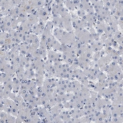 Invitrogen KIAA0355 Polyclonal Antibody 100 &mu;L; Unconjugated:Antibodies,