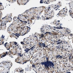 Invitrogen KIAA0355 Polyclonal Antibody 100 &mu;L; Unconjugated:Antibodies,