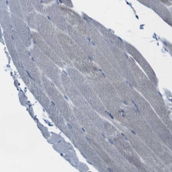 Invitrogen MARCH1 Polyclonal Antibody 100 &mu;L; Unconjugated:Antibodies,