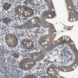 Invitrogen MARCH1 Polyclonal Antibody 100 &mu;L; Unconjugated:Antibodies,