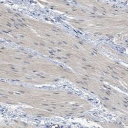 Invitrogen TNFAIP1 Polyclonal Antibody 100 &mu;L | Buy Online | Invitrogen&trade; | Fisher Scientific