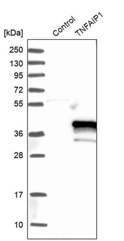 Invitrogen TNFAIP1 Polyclonal Antibody 100 &mu;L | Buy Online | Invitrogen&trade; | Fisher Scientific