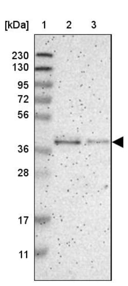 Invitrogen GMPPB Polyclonal Antibody 100 &mu;L | Buy Online | Invitrogen&trade; | Fisher Scientific