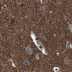 Invitrogen ARHGEF11 Polyclonal Antibody 100 &mu;L; Unconjugated:Antibodies,