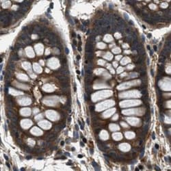 Invitrogen ARHGEF11 Polyclonal Antibody 100 &mu;L; Unconjugated:Antibodies,