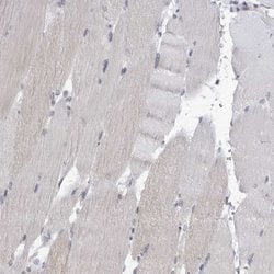 Invitrogen SLC25A22 Polyclonal Antibody 100 &mu;L; Unconjugated:Antibodies,