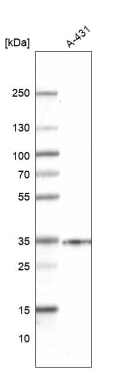 Invitrogen SLC25A22 Polyclonal Antibody 100 &mu;L; Unconjugated:Antibodies,