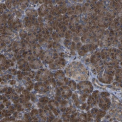 Invitrogen DPM3 Polyclonal Antibody 100 &mu;L; Unconjugated:Antibodies,