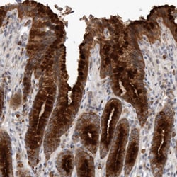 Invitrogen Melanophilin Polyclonal Antibody 100 &mu;L; Unconjugated:Antibodies,