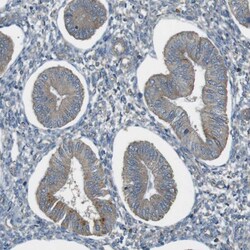 Invitrogen ZDHHC20 Polyclonal Antibody 100 &mu;L; Unconjugated:Antibodies,