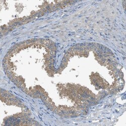 Invitrogen ZDHHC20 Polyclonal Antibody 100 &mu;L; Unconjugated:Antibodies,