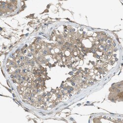 Invitrogen ZDHHC20 Polyclonal Antibody 100 &mu;L; Unconjugated:Antibodies,