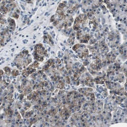 Invitrogen Kir3.4 (KCNJ5) Polyclonal Antibody 100 &mu;L; Unconjugated:Antibodies,