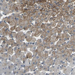 Invitrogen SLC13A3 Polyclonal Antibody 100 &mu;L; Unconjugated:Antibodies,
