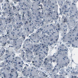 Invitrogen SLC13A3 Polyclonal Antibody 100 &mu;L; Unconjugated:Antibodies,