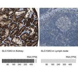 Invitrogen SLC13A3 Polyclonal Antibody 100 &mu;L; Unconjugated:Antibodies,