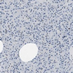 Invitrogen ARL6IP6 Polyclonal Antibody 100 &mu;L | Buy Online | Invitrogen&trade; | Fisher Scientific