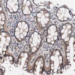 Invitrogen CYB561 Polyclonal Antibody 100 &mu;L; Unconjugated:Antibodies,
