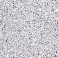 Invitrogen CYB561 Polyclonal Antibody 100 &mu;L; Unconjugated:Antibodies,