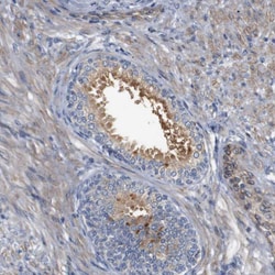 Invitrogen CYB561 Polyclonal Antibody 100 &mu;L; Unconjugated:Antibodies,