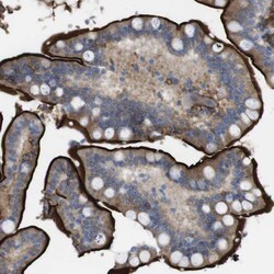 Invitrogen CYBRD1 Polyclonal Antibody 100 &mu;L; Unconjugated:Antibodies,
