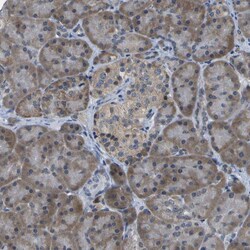 Invitrogen DSE Polyclonal Antibody 100 &mu;L; Unconjugated:Antibodies,