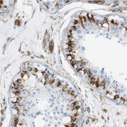 Invitrogen MS4A10 Polyclonal Antibody 100 &mu;L; Unconjugated:Antibodies,