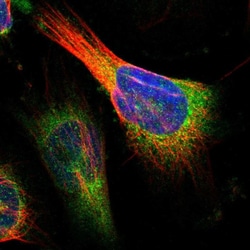Invitrogen CLPTM1L Polyclonal Antibody 100 &mu;L; Unconjugated:Antibodies,
