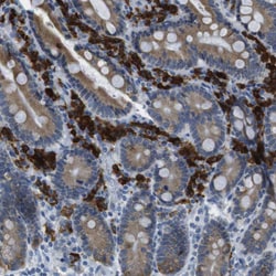 Invitrogen CLPTM1L Polyclonal Antibody 100 &mu;L; Unconjugated:Antibodies,
