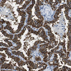 Invitrogen CLPTM1L Polyclonal Antibody 100 &mu;L; Unconjugated:Antibodies,