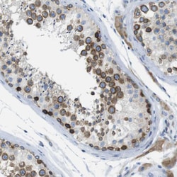 Invitrogen CLPTM1L Polyclonal Antibody 100 &mu;L; Unconjugated:Antibodies,