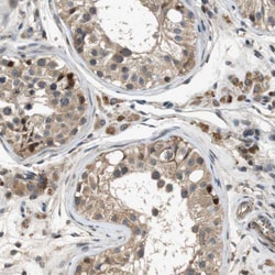Invitrogen STCH Polyclonal Antibody 100 &mu;L; Unconjugated:Antibodies,