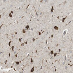 Invitrogen MBOAT2 Polyclonal Antibody 100 &mu;L; Unconjugated:Antibodies,