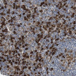 Invitrogen MBOAT2 Polyclonal Antibody 100 &mu;L; Unconjugated:Antibodies,