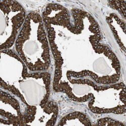Invitrogen MBOAT2 Polyclonal Antibody 100 &mu;L; Unconjugated:Antibodies,