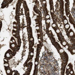 Invitrogen MBOAT2 Polyclonal Antibody 100 &mu;L; Unconjugated:Antibodies,