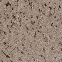 Invitrogen PTPLAD1 Polyclonal Antibody 100 &mu;L; Unconjugated:Antibodies,