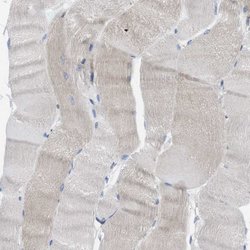 Invitrogen PTPLAD1 Polyclonal Antibody 100 &mu;L; Unconjugated:Antibodies,