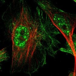 Invitrogen CTR2 Polyclonal Antibody 100 &mu;L; Unconjugated:Antibodies,