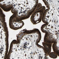 Invitrogen CTR2 Polyclonal Antibody 100 &mu;L; Unconjugated:Antibodies,